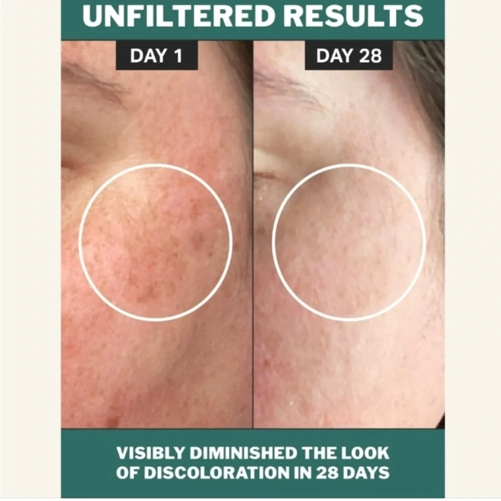 Cocokind chlorophyll discoloration serum 1 fl oz‎ bottle